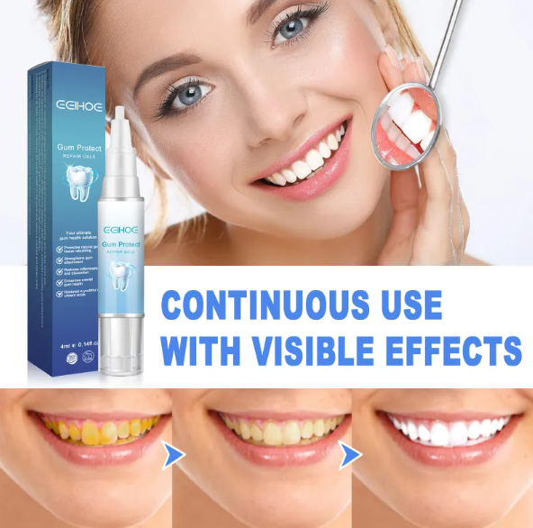 Teeth Repair Gel gods grace