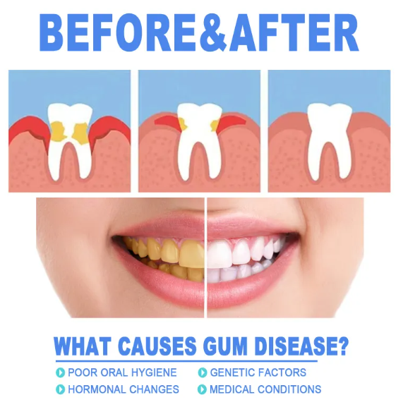 Teeth Repair Gel gods grace