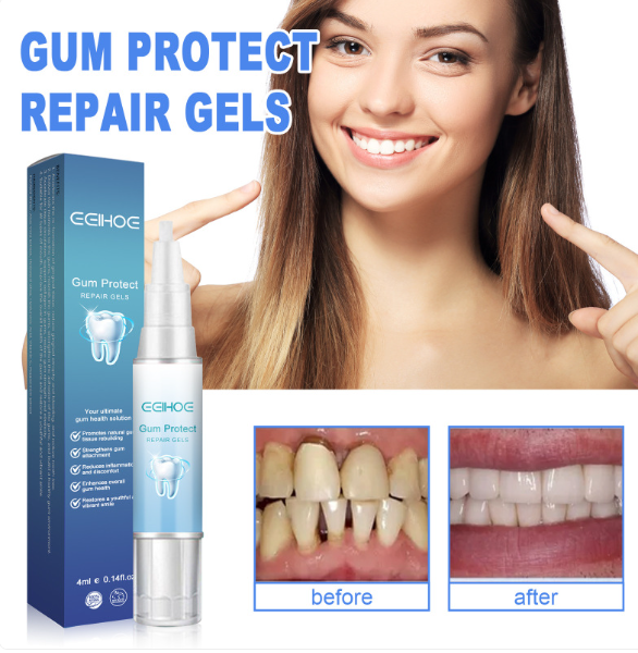Teeth Repair Gel gods grace